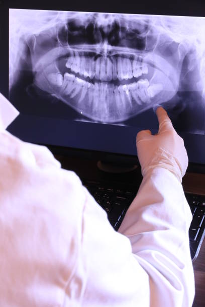 Best Emergency Tooth Extraction in Bushyhead, OK